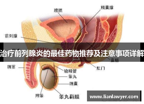 治疗前列腺炎的最佳药物推荐及注意事项详解